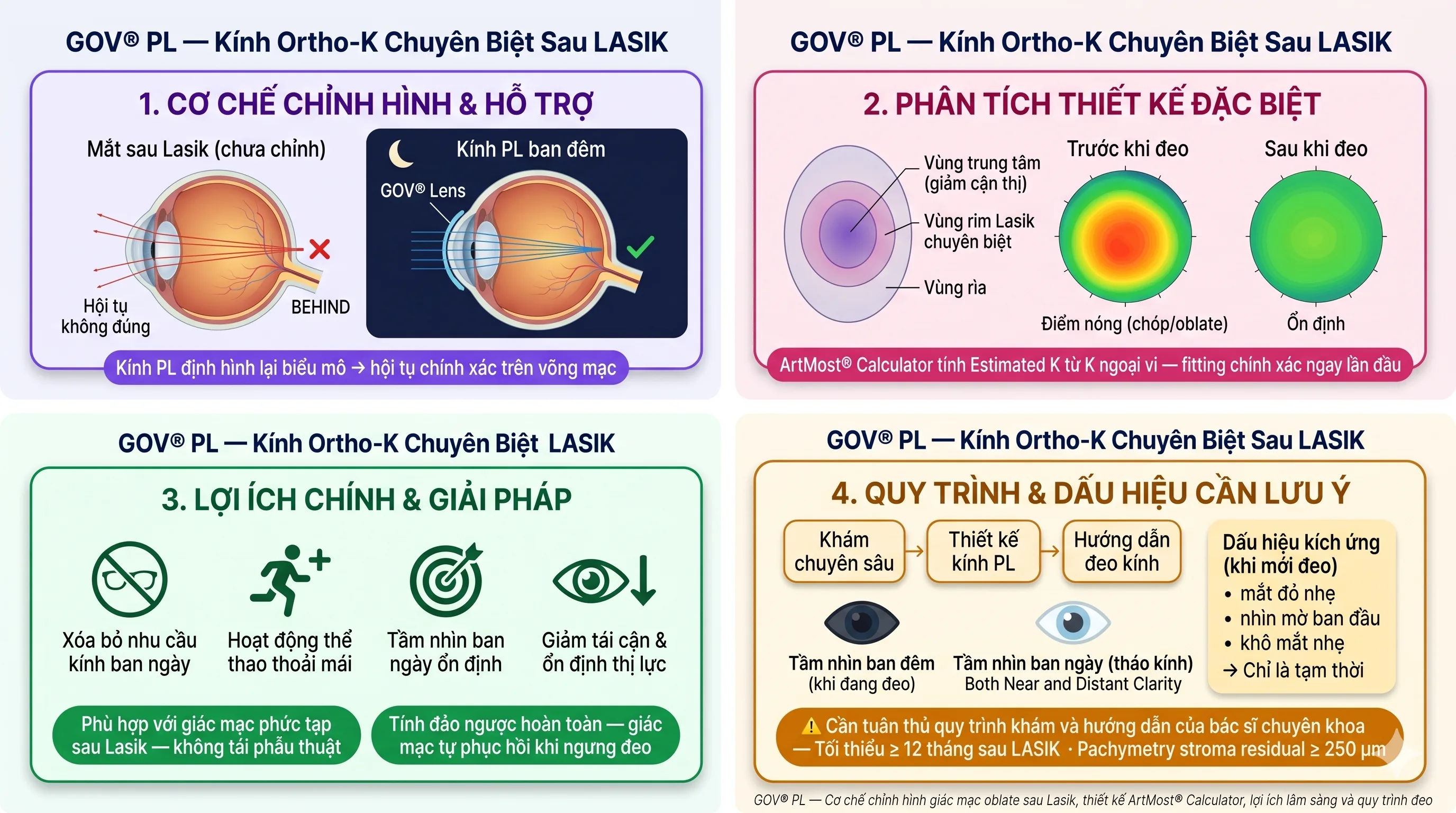GOV Post-Lasik: cơ chế chỉnh hình, thiết kế đặc biệt, lợi ích và quy trình