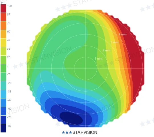 Bản đồ Elevation ca Quadrant (4,4) — đỉnh lệch chéo vào một góc phần tư: độ cao dốc theo đường chéo, bốn góc khác nhau hẳn